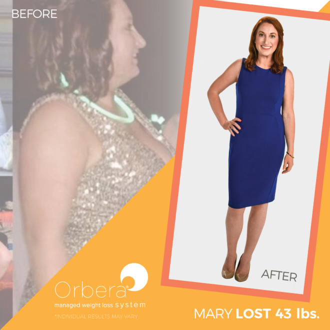 2019-Aug-OBERA-BeforeAfter-1080x1080-FNL-Mary43